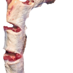 oxHaler oxHaler