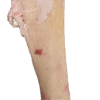 SF Sener/Tendons