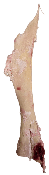 SF Sener/Tendons